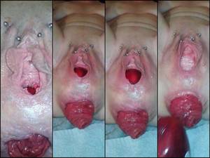 Big Prolapse Porn - undefined