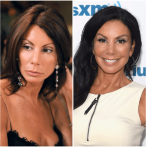 danielle staub - Danielle Staub's Plastic Surgery: The RHONJ Star Loves Her Botox