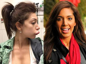 Farrah Abraham Before Porn - Farrah Abraham after (left) and before the surgery. Image taken from  Abraham's Facebook