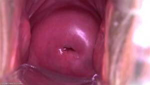 Beautiful Cervix Porn - Watch Tidy Twat - Cervix, Closeup, Speculum Porn - SpankBang