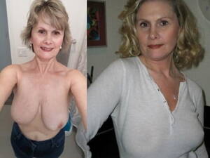 Before And After Gilf Porn - Granny Tits Before After | Sex Pictures Pass