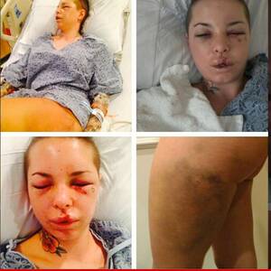 Christy Porn Star - Christy Mack -- War Machine Almost Killed Me ... 18 Broken Bones, Ruptured  Liver