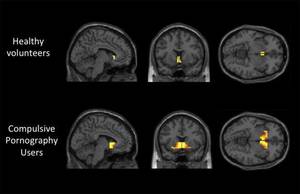 Brain Fuck Porn - Pornography addiction leads to same brain activity as alcoholism or drug  abuse, study shows