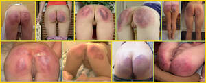 marks on bare ass whipping - Bottom Marks Spanking Website >>> Corporal Punishment Videos, Domestic  Spanking Galleries, British v American OTK Cane, Paddle & Tawse Images!