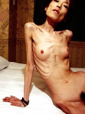 Anorexia - Anorexia Porn Pics - 50 photos