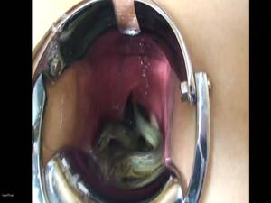 Eel Anal Porn - Filling ass with eels - LuxureTV