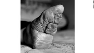 bound asian feet - Close-up of Su Xi Rong's left foot forced into the