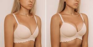 breast implants asian teen - 7,150 Breast Augmentation Royalty-Free Images, Stock Photos & Pictures |  Shutterstock