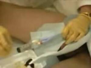 Male Catheter Insertion Porn - Insertion Of Male Catheter - Painful! : XXXBunker.com Porn Tube