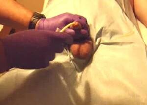 Male Catheter Insertion Porn - The catheter is inserted into the penis - ThisVid.com