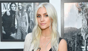 Ashlee Simpson Cum - Did Ashlee Simpson Get More Plastic Surgery? Experts Say Yes!