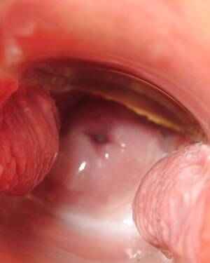 Beautiful Cervix Porn - Cervix Porn Pics - PICTOA