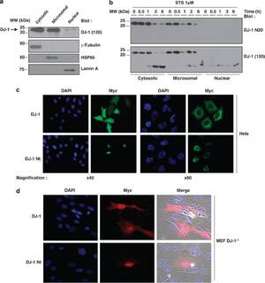 Girlsdoporn E327 - The caspase 6 derived N-terminal fragment of DJ-1 promotes apoptosis via  increased ROS production | Cell Death & Differentiation