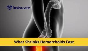 Immediate Relief For Anal Fissures - What Shrinks Hemorrhoids Fast? Preventions And Treatments