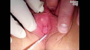 examine pussy teen - Teen Britney gyno pussy speculum exam - XVIDEOS.COM