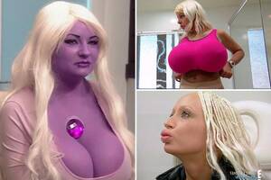 Bunny Blaze Porn - The most shocking cases from the Botched clinic... including a purple  patient and a woman whose sheep's fat fillers were STILL growing 12 years  later | The Sun