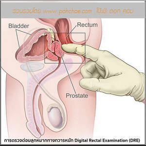 Hot Anal Porn Anatomy - Know your ass for better sex | PULSE CLINIC - Asia's Leading Sexual  Healthcare Network.