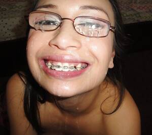 Braces Porno - BRACES PORN - 51 photos