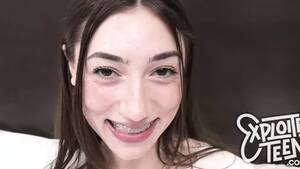 Braces Porno - 1237 Braces Sex Videos From 4kPorn.xxx