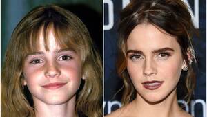 Emma Watson Porn Teacher - Emma Watson Transformation: From 'Harry Potter' to Now