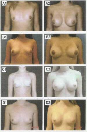 breast sizes nude - Nude Breast Size Chart - XXGASM