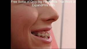 braces anal angel porn - Sandra Skinny Teen Braces Anal Facial - XVIDEOS.COM