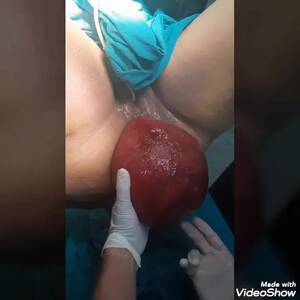 Accidental Anal Prolapse - Dirty: Monster Anal Prolapse - ThisVid.com