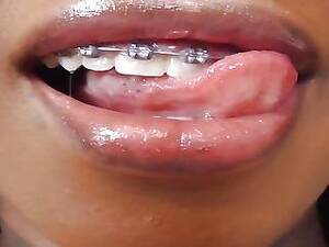 braces anal angel porn - Braces Tube - 18QT Free Porn Movies, Sex Videos