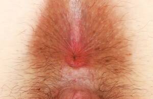 Dirty Butthole - Dirty Butthole Porn Pics & Naked Photos - PornPics.com