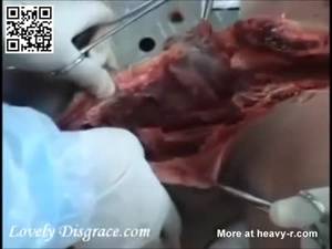 Ebony Fucking Dead Body - Detail autopsy