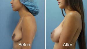 before and after lactating tits - Dual breast pump self milking - Porn for Women, Breast Milking, Breast Pump  - MobilePorn