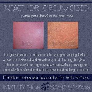 Circumcised Vs Uncircumcised Porn - Intact or Circumcised: Penis Glans (head) in the Adult Male (work safe  version)