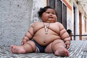 big fat black babies - Morbidly obese baby leaves doctors baffled tipping the scales at nearly  THREE stone at just eight months - Mirror Online