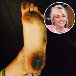 Miley Cyrus Foot Fetish - Miley Cyrus Foot Fetish | Sex Pictures Pass