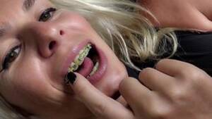 Mature Braces Porn - Braces porn videos | free â¤ï¸ vids | Tiava