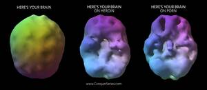 Mind Porn - Your Brain on Porn