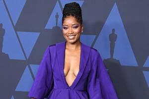 Keke Palmer Porn - Keke Palmer Shared Skincare Struggles to Show 'I'm Not Perfect'