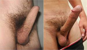 Circumcised Vs Uncircumcised Porn - File:Uncircumcised and circumcised erect comparison.jpg - Wikimedia Commons