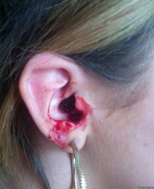 Bleeding Mouth Porn - Marnie-Rae Harvey's ear. \