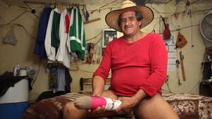 19 Inch Penis Porn - Who is Roberto Esquivel Cabrera and does he have the biggest penis in the  world? â€“ The Sun | The Sun