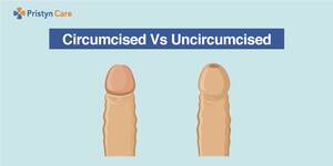 Circumcised Vs Uncircumcised Porn - Circumcised Vs Uncircumcised - Pristyn Care