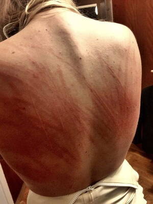 marks on bare ass whipping - Whip marks on female backs | MOTHERLESS.COM â„¢