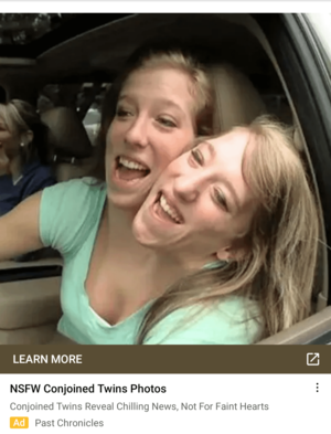 Conjoined Twin Porn Fuck - ah yes, nsfw conjoined twins photos : r/shittymobilegameads