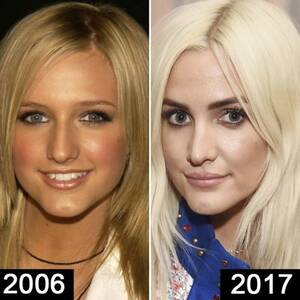 Ashlee Simpson - Did Ashlee Simpson Get More Plastic Surgery? Experts Say Yes!