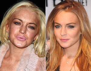 Lindsay Lohan Pussy - liverpool = lindsay lohan â€“ Wrong Side of the Pond