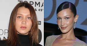 Bella Lynn - Did Bella Hadid Get Plastic Surgery? Transformation Photos