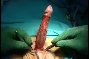 beautiful transgender pussy - Male To Female Sex CHange Surgery