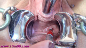 Huge Speculum Porn - Free Porn Pictures with the Best Cervix Sex Images. Cervix Play Photo  Gallery