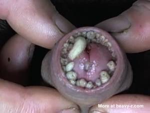 disgusting - It is rabble in penile skin in maggots