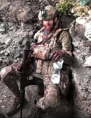 military - Wounded Ukrainian soldier after a fight [1024x1280] : r/MilitaryPorn